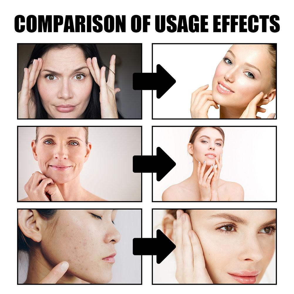 Ejderha Kan Kremi Kırışıklık G - Skincare Retinol incelemesi ve fiyatı