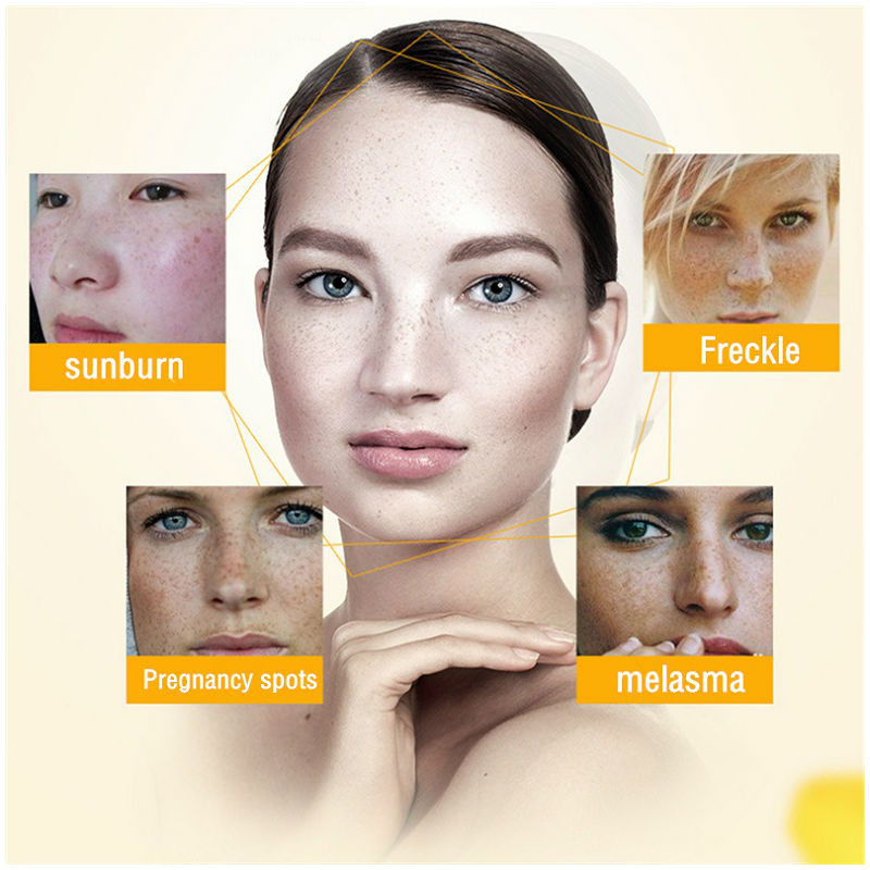 Dimollaure Beyazlatıcı Çil Kre - Skincare Retinol incelemesi ve fiyatı