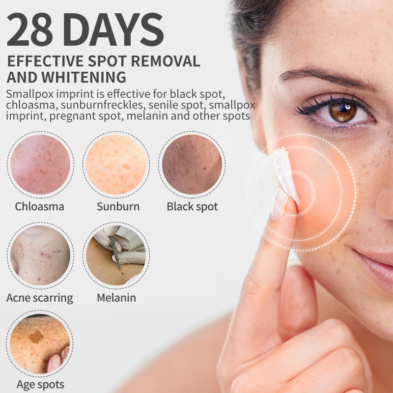 Dimollaure Beyazlatıcı Çil Kre - Skincare Retinol incelemesi ve fiyatı